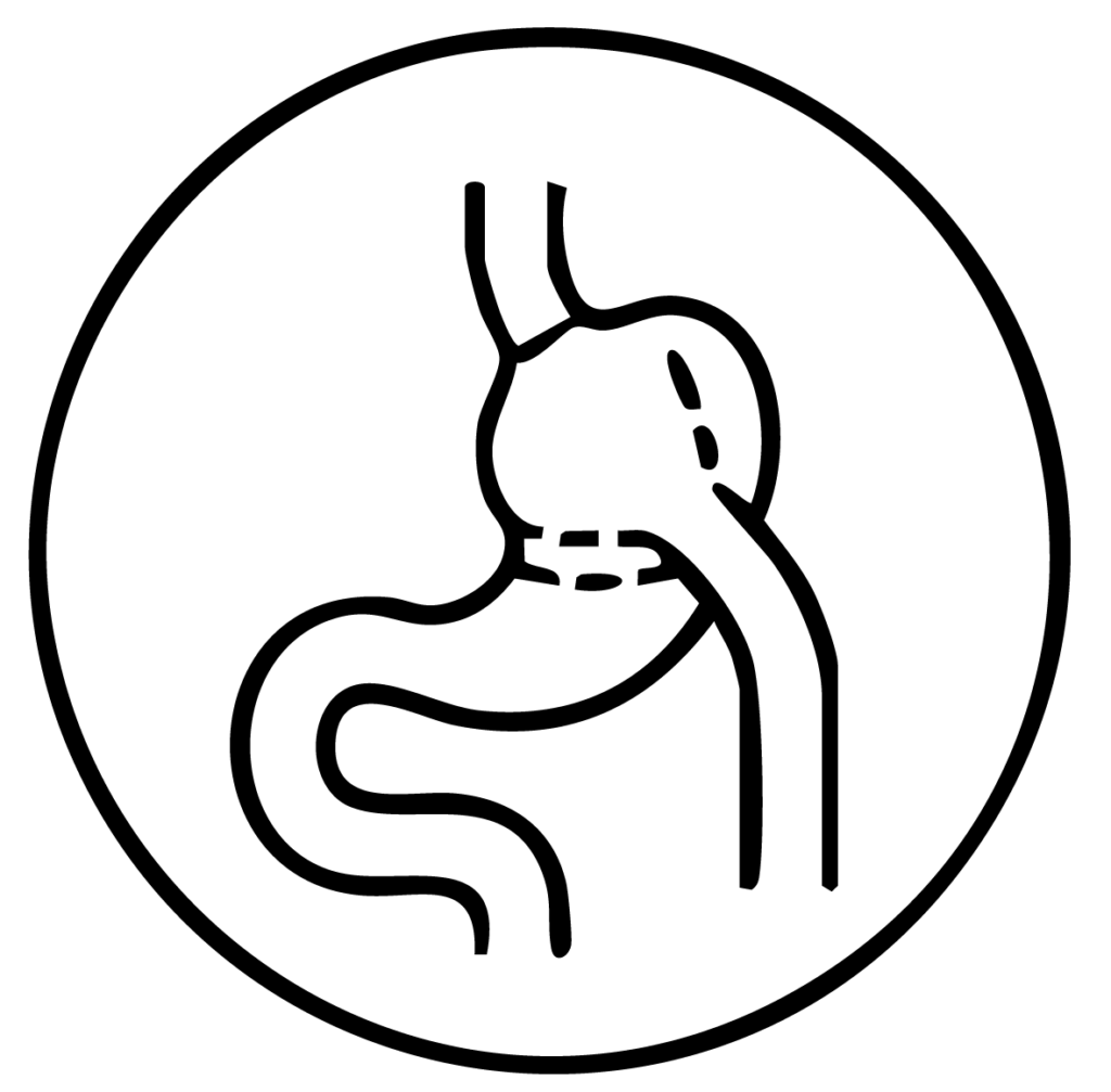 Icono de Bypass gástrico